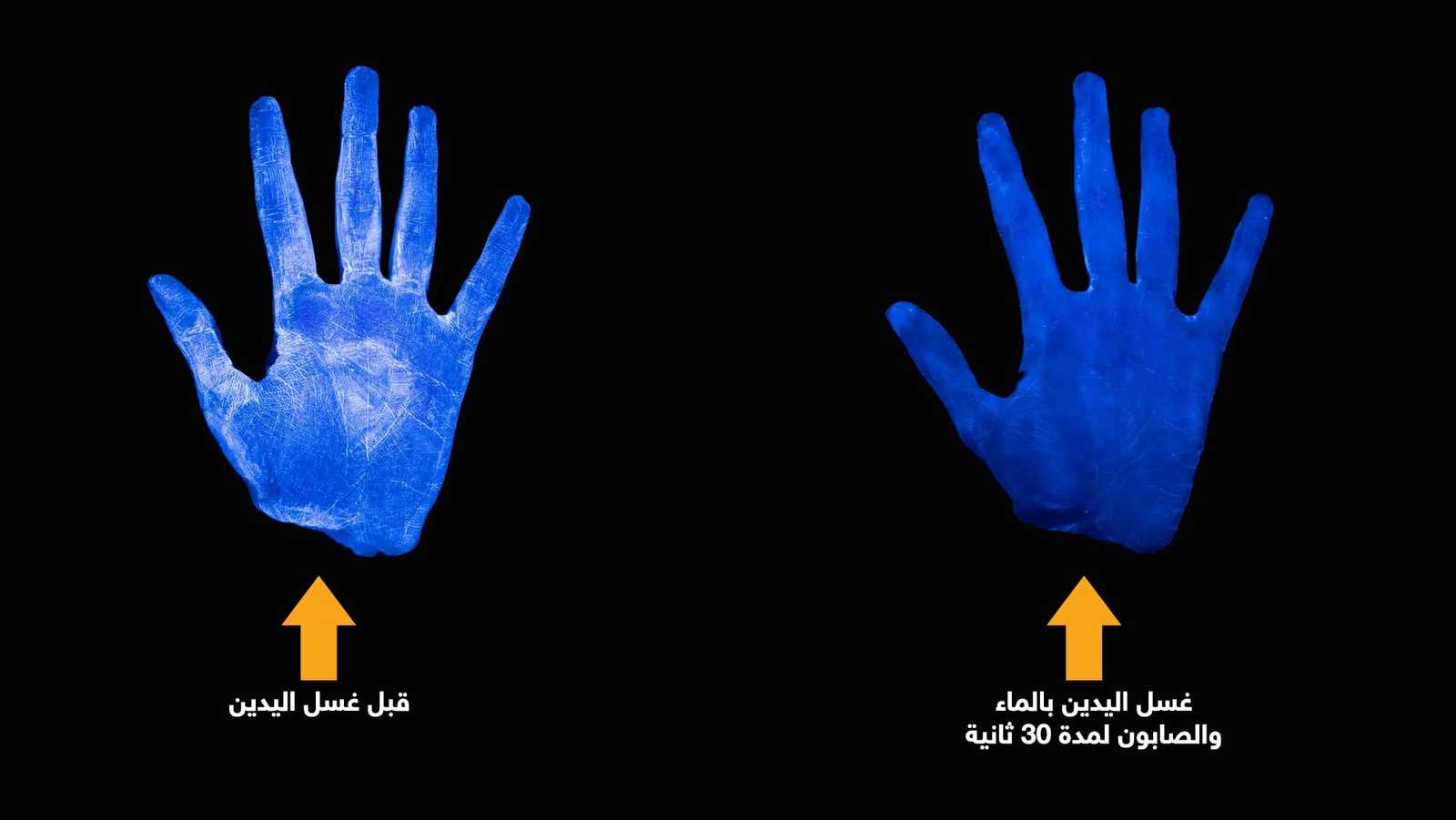 الفرق بين عدم غسل اليد وغسل اليد يالصابون