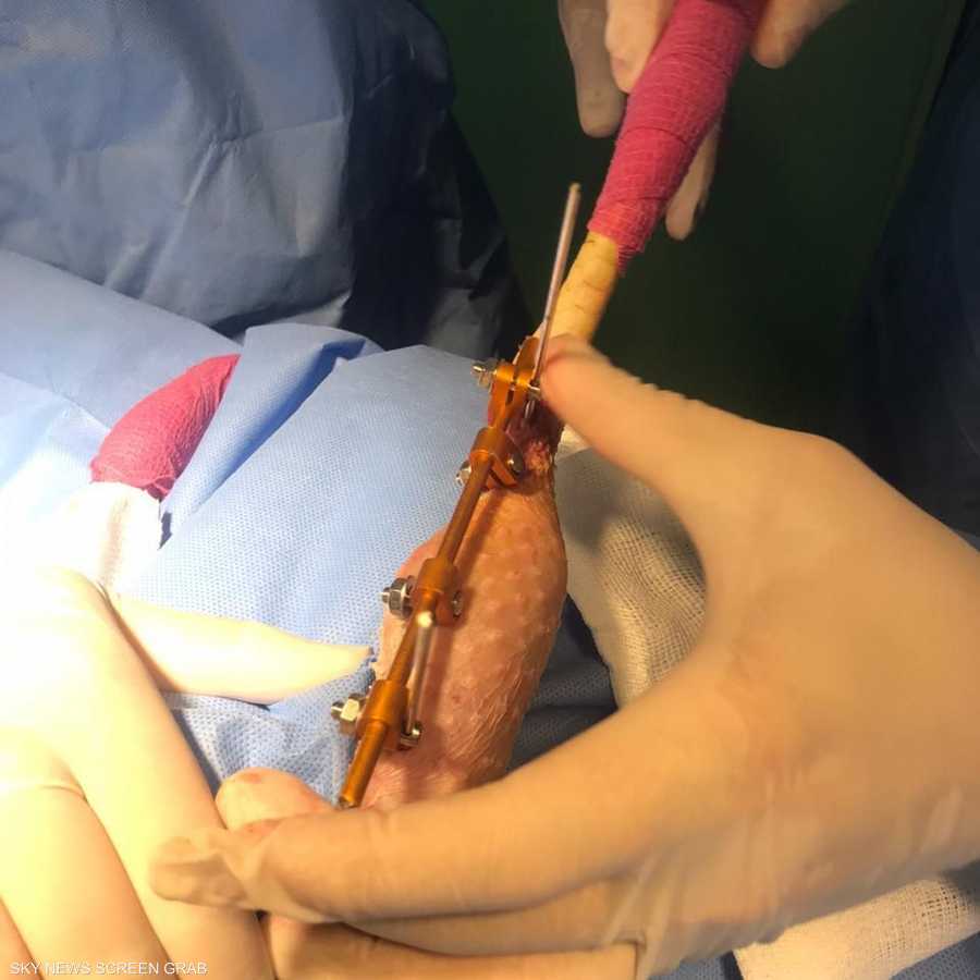 صورة من العملية الجراحية
