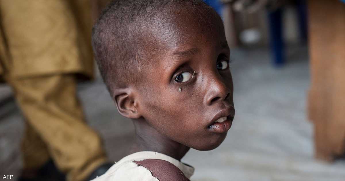 المجاعة تهدد 22 مليون شخص على الأقل في القرن الإفريقي | سكاي نيوز عربية