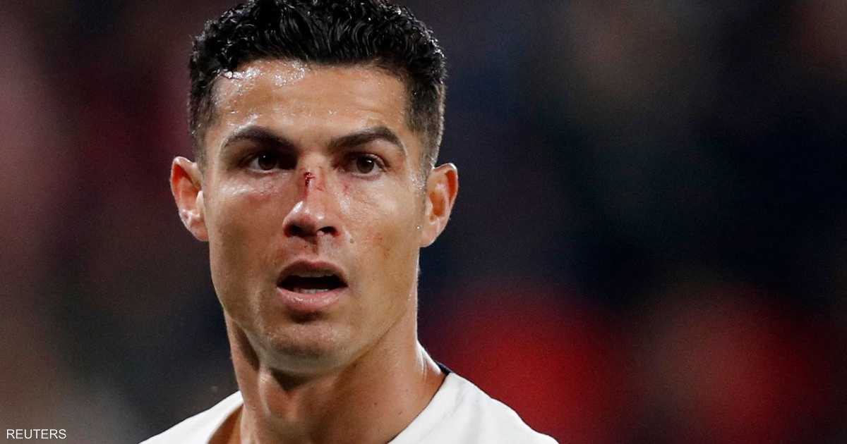 Ronaldo suffered a severe injury in the match against the Czech Republic
