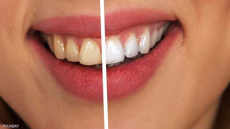 8. <br/>التأثيرات السلبية لتخلخل الأسنان على الصحة العامة.