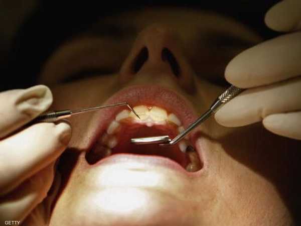 يعاني نصف سكان العالم تقريبا من تسوس الأسنان.