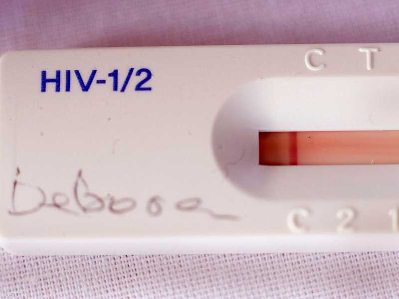 مرض hiv الأعراض المبكرة